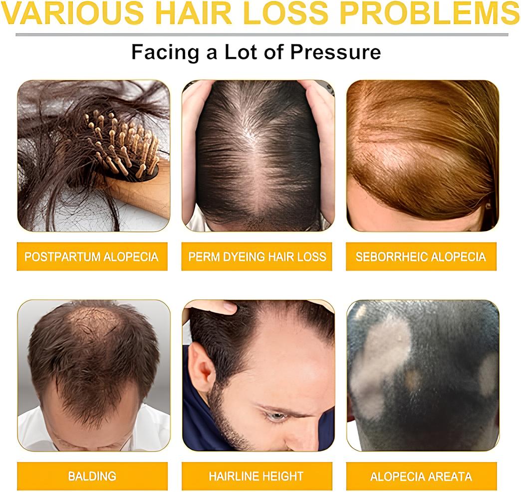 Olim Naturals Biotin Hair Growth Serum