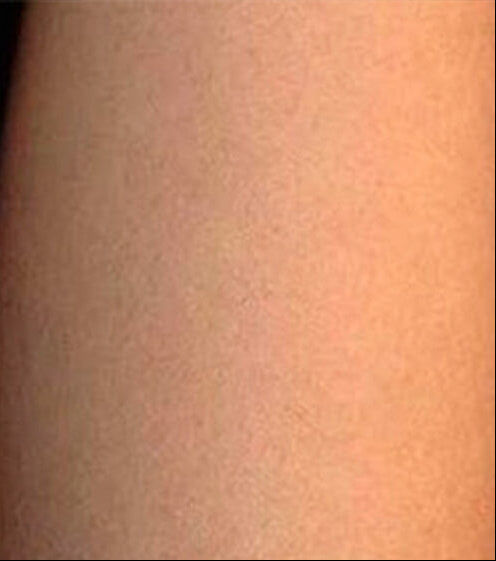 Arms - After