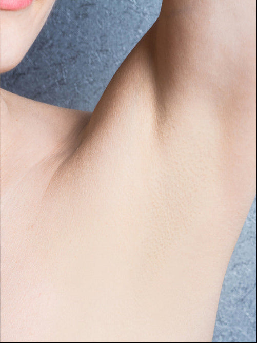 Underarms - After